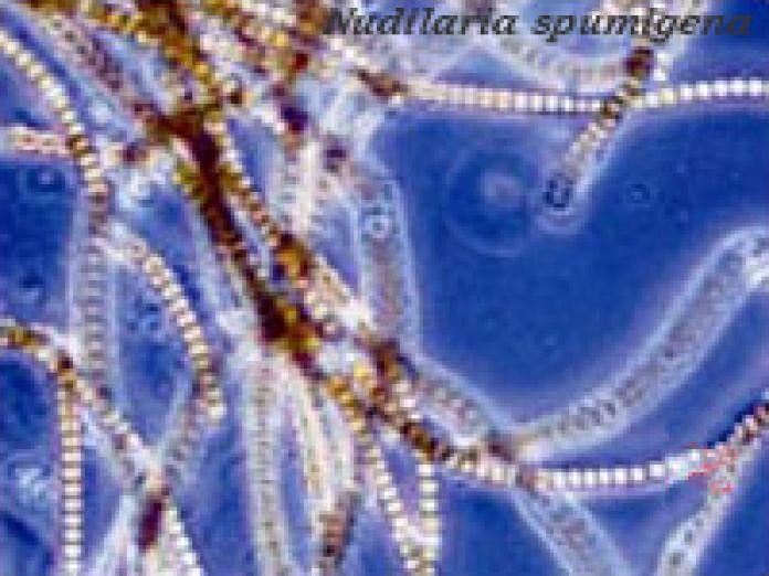 Planteplankton af arten Nodularia spumigena.