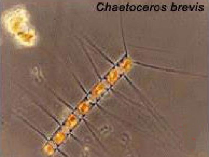 Planteplankton af arten Chaetoceros.